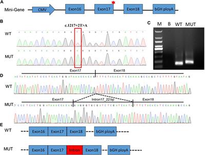 A novel variation in DEPDC5 causing familial focal epilepsy with variable foci